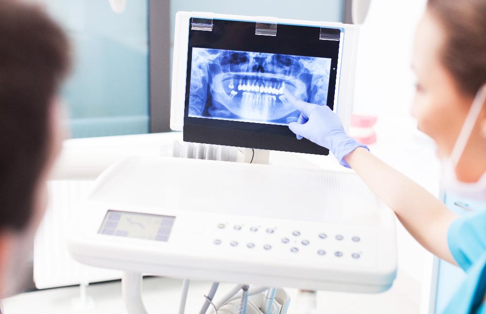 close up of dental x-ray | cosmetic dentist st paul mn
