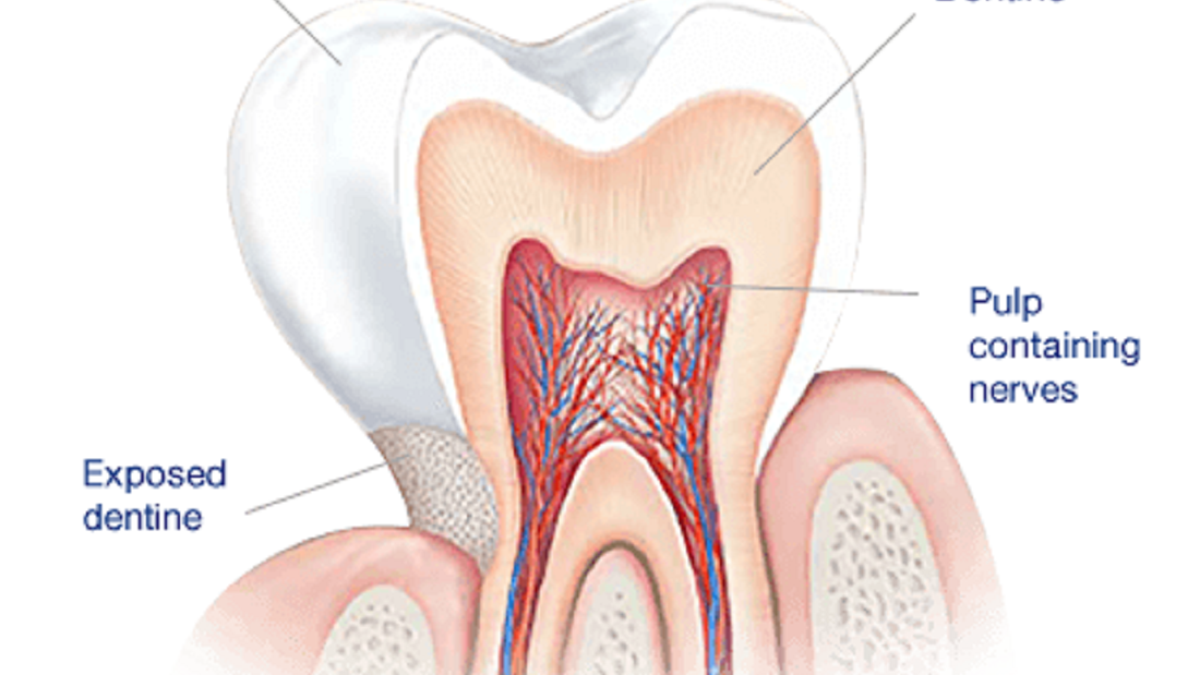 Cosmetic Dentist St Paul MN How to Manage Sensitive Teeth