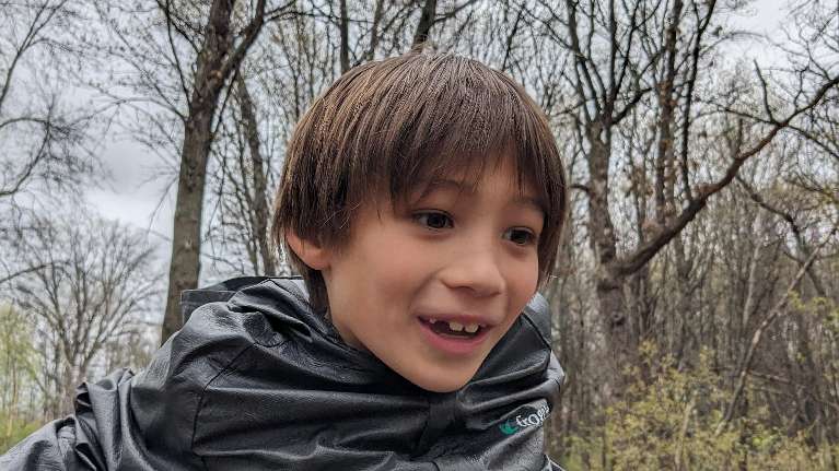 girl holding missing tooth | childrens dentist st paul mn