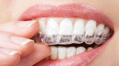 close up of woman using invisalign 